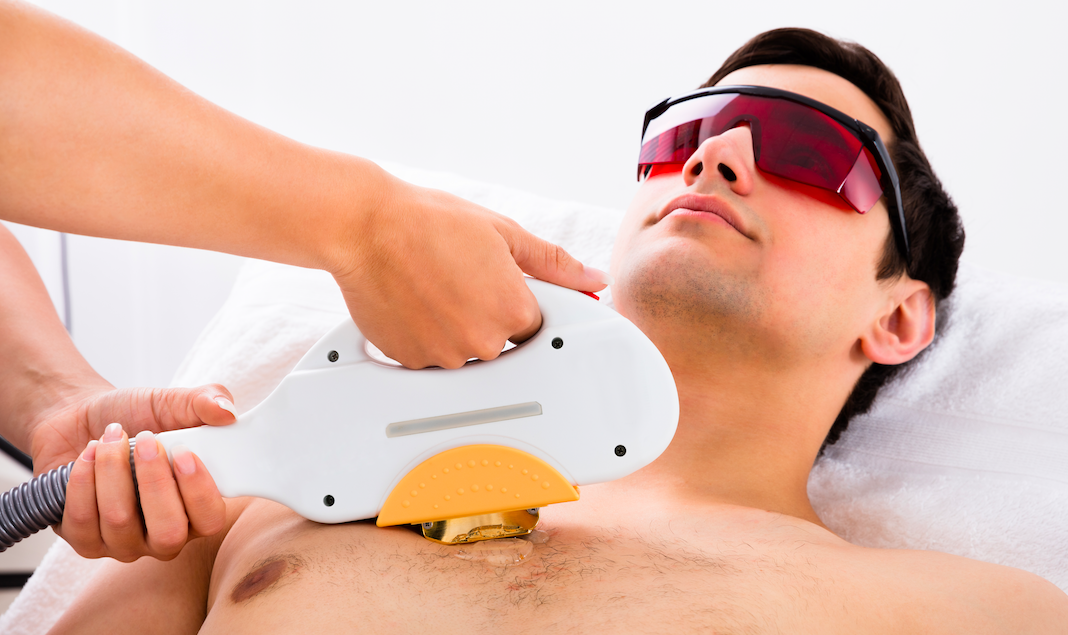 male getting laser done male getting laser done griffinshouse